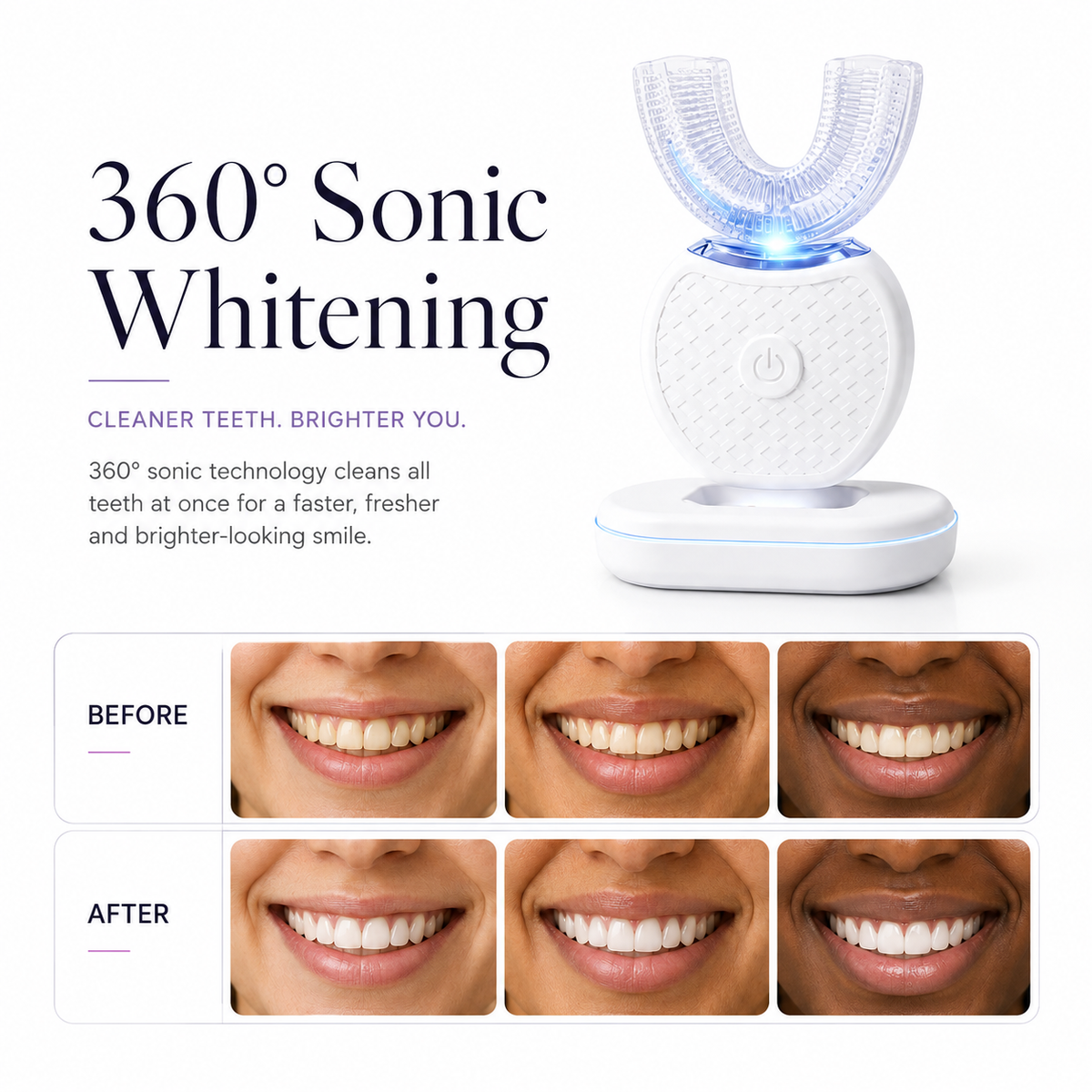 The Ultimate 360° Sonic Kit